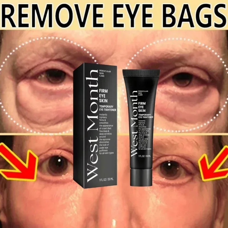 Eye Bags Cream Instant Removes Dark Circles Tightens The Eyes Lifting Firming And Removing Eye Bags Make Your Eyes More Lively - Luvia