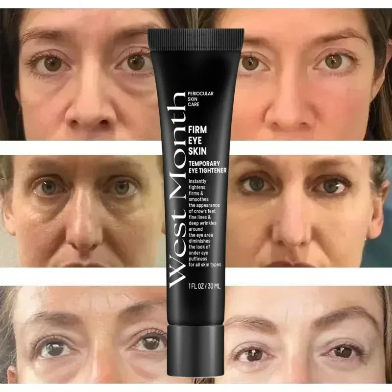 Eye Bags Cream Instant Removes Dark Circles Tightens The Eyes Lifting Firming And Removing Eye Bags Make Your Eyes More Lively - Luvia